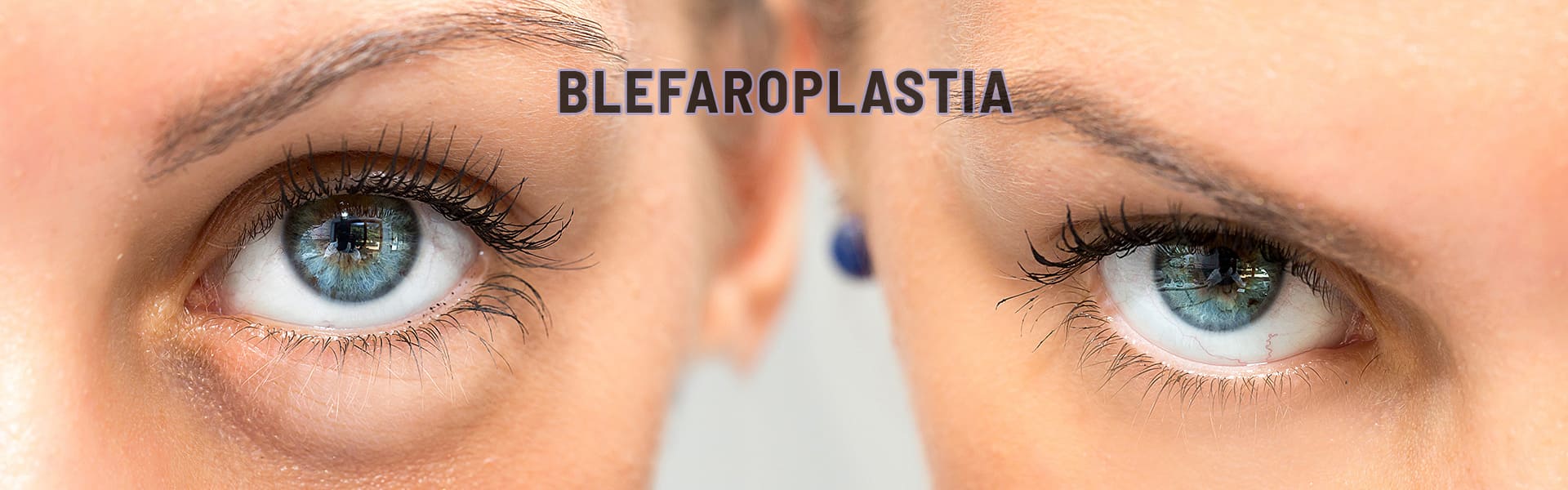 Blefaroplastia